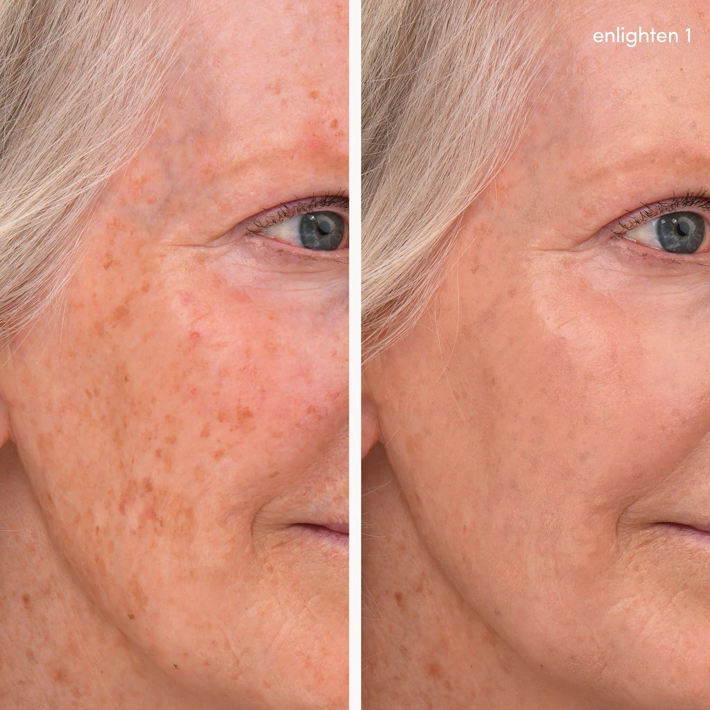 Enlighten Concealer 1