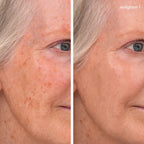 Enlighten Concealer 1