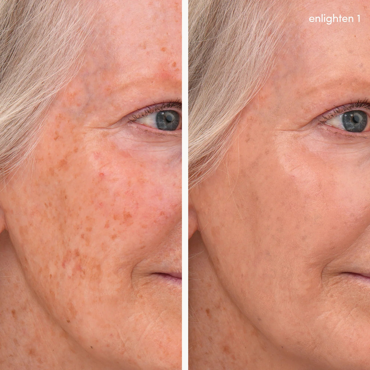 Enlighten Concealer 1