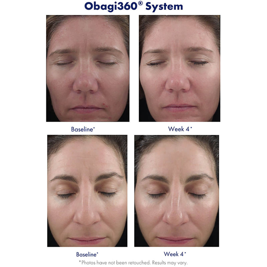 Retinol 1.0