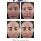 Retinol 1.0