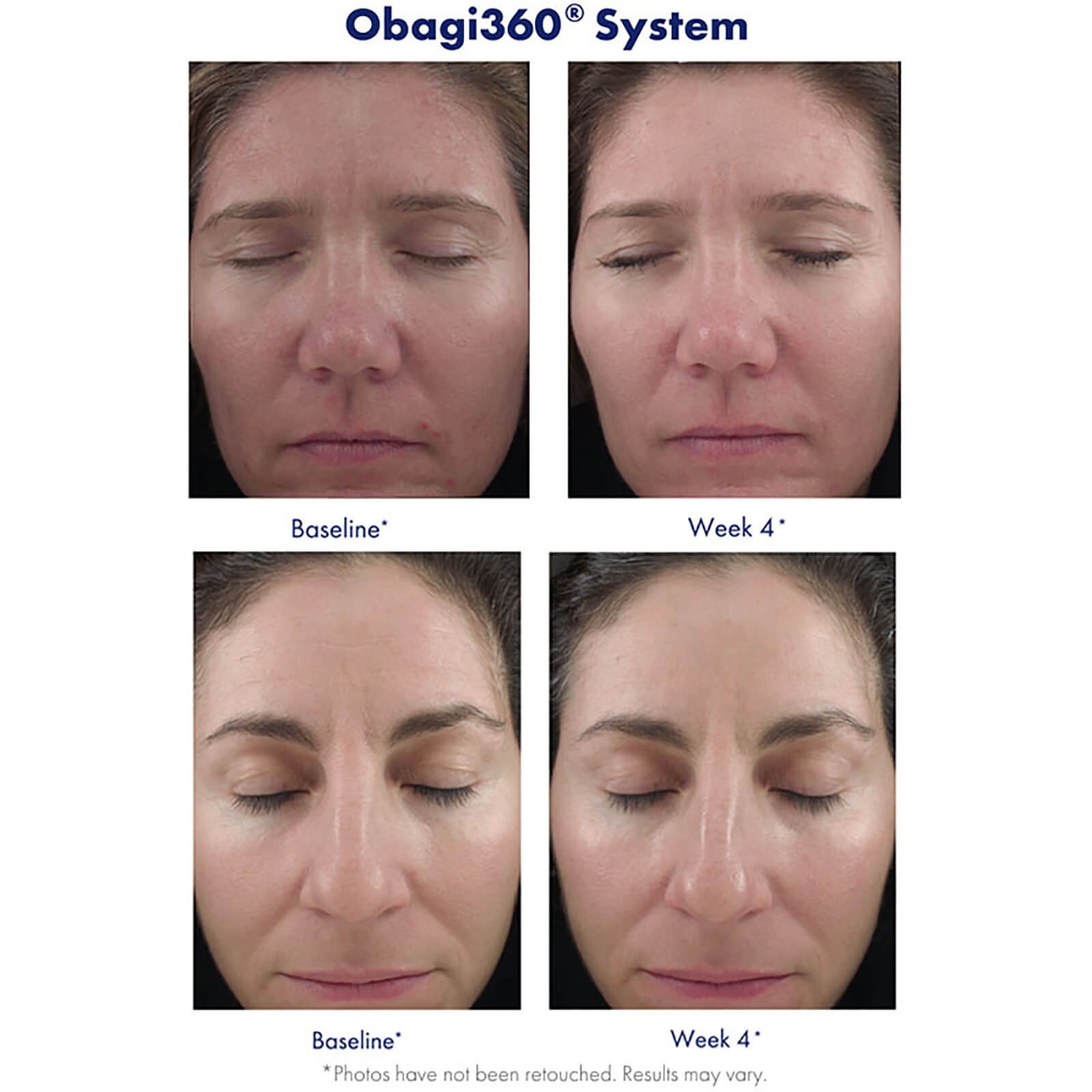 Retinol 1.0
