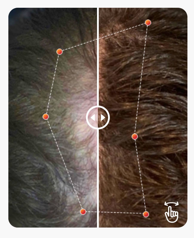 REVIAN RED Hair Growth System | Red Light Therapy Cap for Hair Growth