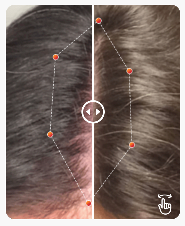 REVIAN RED Hair Growth System | Red Light Therapy Cap for Hair Growth