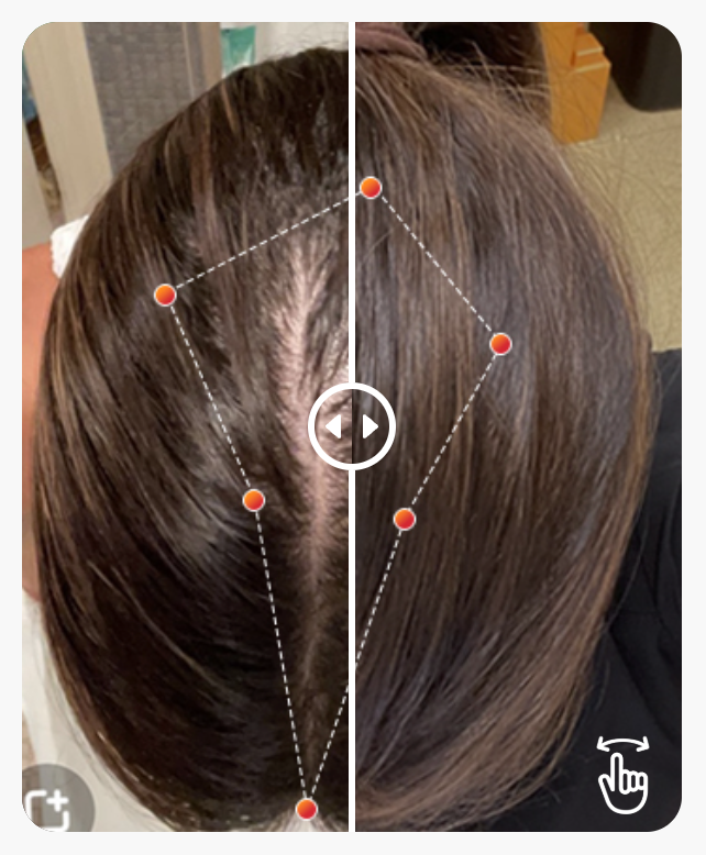 REVIAN RED Hair Growth System | Red Light Therapy Cap for Hair Growth