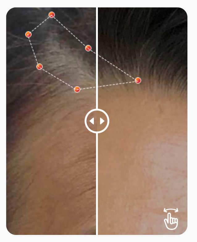 REVIAN RED Hair Growth System | Red Light Therapy Cap for Hair Growth