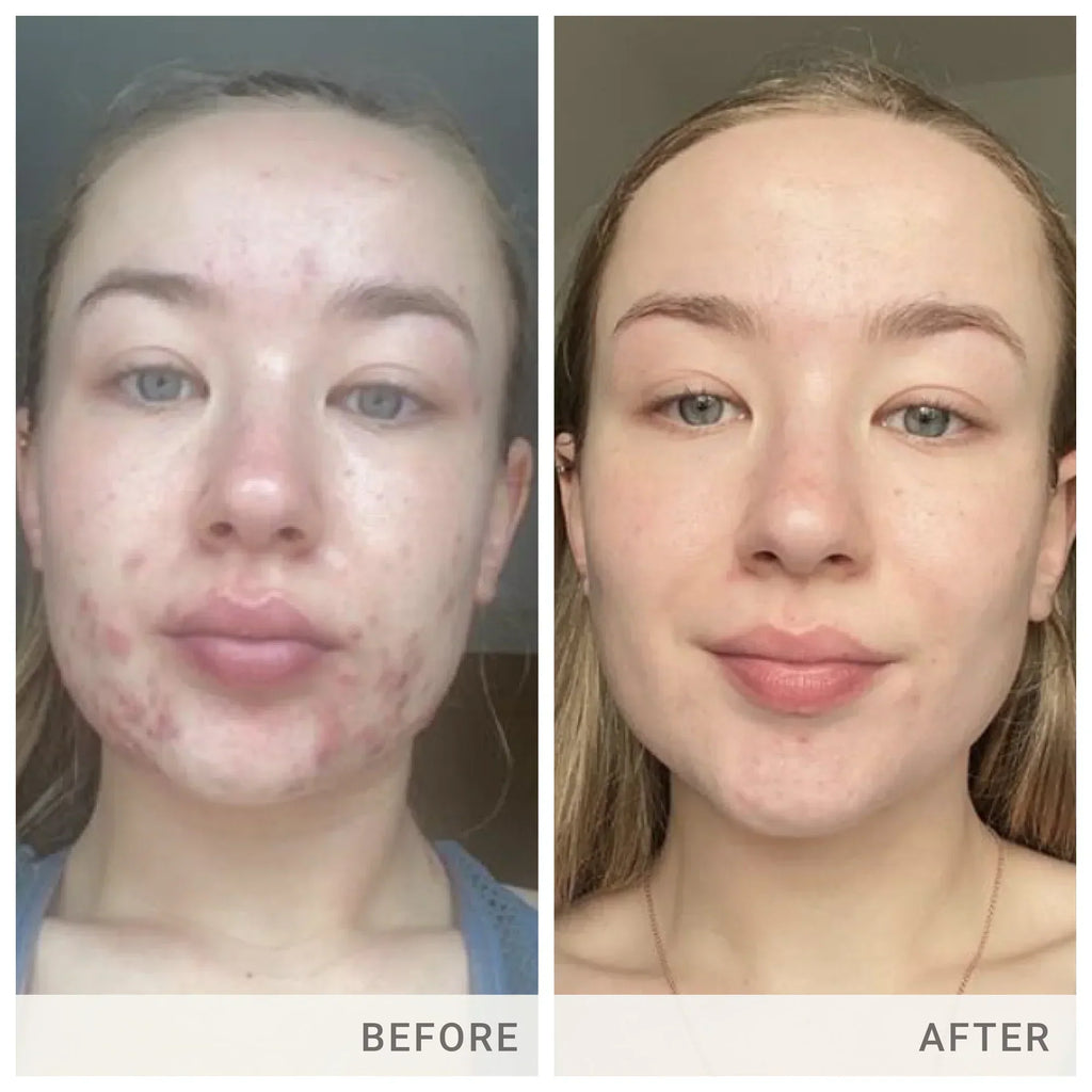 Skin Accumax 180 ct
