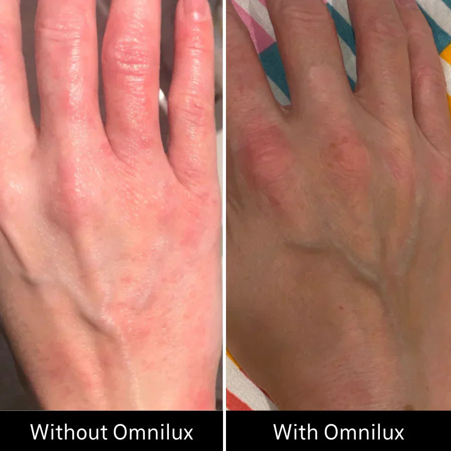 Omnilux Contour Glove